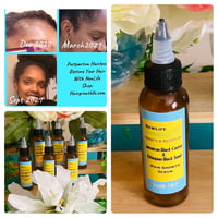 Jamaican Black Castor  Hair Growth Serum 2oz