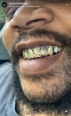 Custom Smile on the Rockz Grill