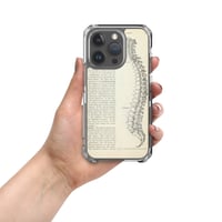 Image 11 of Vintage Book Page Anatomical Illustration Human Spine Clear Case for iPhone®