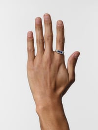 Image 3 of Femur Ring