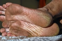 Image 5 of EXTREME SALTY FEET SOAK & SCRUB & EXTREME FOOT CREAM