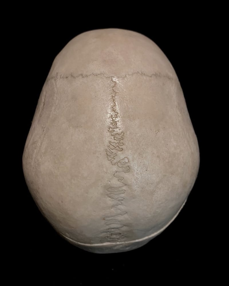 Image of Real Human Skull