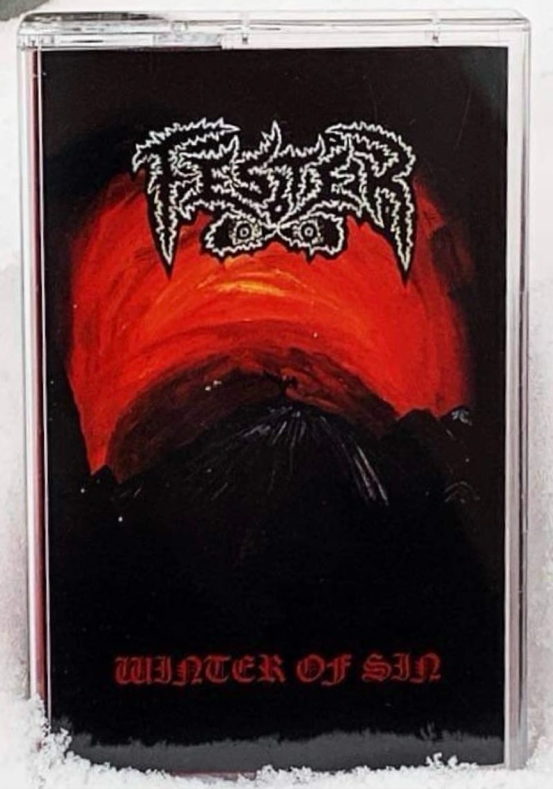 Cassette Bundle