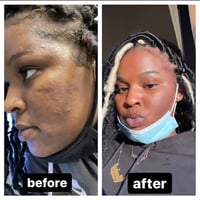 Image 4 of Turmeric Tangerine Lemon Facial Bar (PRE ORDER APRIL 16th RESTOCK)