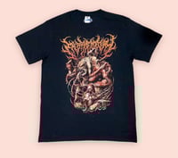 Image 2 of Embryectomy - Version 1