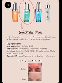 Image 3 of 2% Salicylic Acid Serum