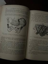 Image 8 of Précis de pathologie médicale, 2 tomes, collection de precis médicaux Masson, 1920