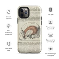 Image 3 of Antique Bookpage Detailed Anatomical Illustration Human Skull Tough Case for iPhone®