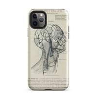 Image 3 of Antique Bookpage Detailed Anatomical Illustration Human Head Tough Case for iPhone®