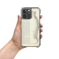 Image 2 of Vintage Book Page Anatomical Illustration Human Spine Clear Case for iPhone®