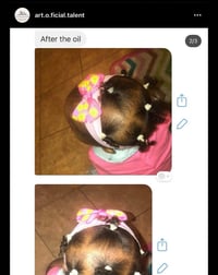 Image 3 of ArtOFicial Hair Growth Oil
