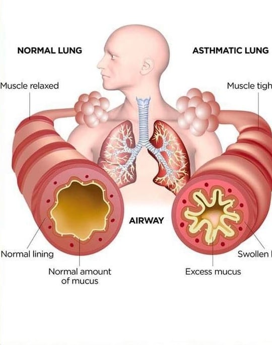MULLE-IN It Over! Mullein Bush Leaf Tea For Respiratory-Breathing-Lung-Fever-Cough Support