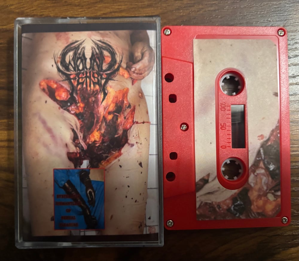 Wound Fetish - A Systematic Dismantling of Sexual Pleasure Cassette