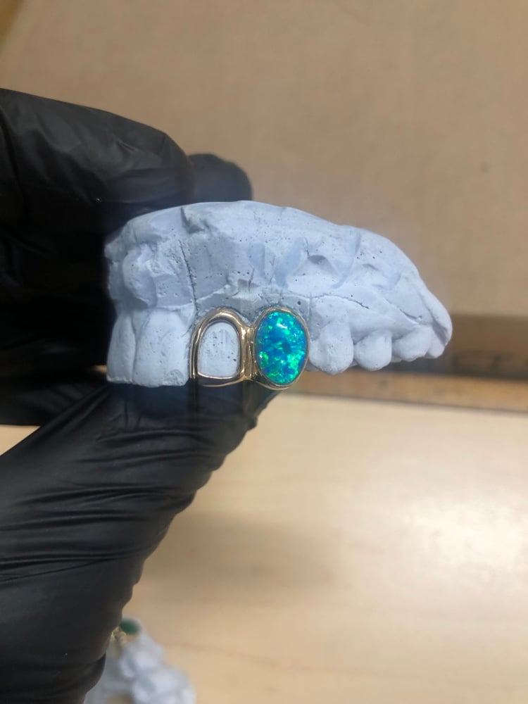 Image of 2 teeth grillz with one Opal 10k yellow gold 