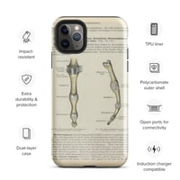 Image 4 of Antique Bookpage Detailed Anatomical Illustration Finger Bones Tough Case for iPhone®