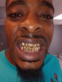 Image 4 of 6/6 Top and bottom 10k Solid Gold Grill set Deal 