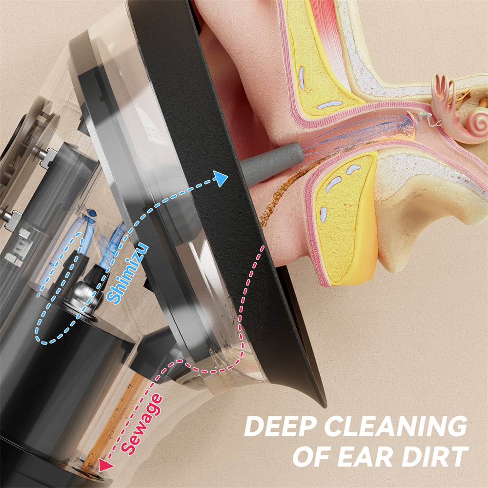 Image of Electric Ear Wax Removal System Water Powered Ear Cleaning Tool with Irrigation Flusher 3 Pressure S