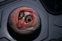 Image 15 of Custom Swappable Phone Grip for smartphones, double iris, reflective pupil, glow in the dark