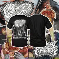 TS - Fetal Deformity “LUPUS” Shirt