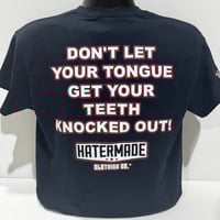 Image 1 of "Teeth Knocked Out" 