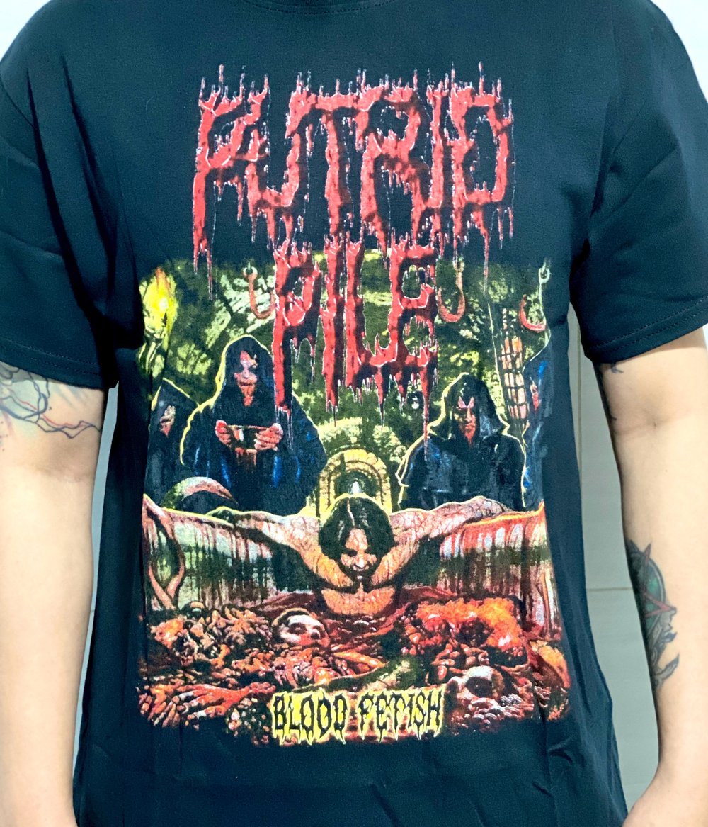 Pathology / Putrid Pile / Cerebral Incubation / Pyaemia 