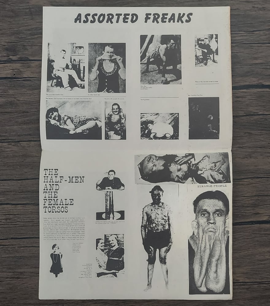Freaks – A Collector’s Edition of Nature’s Human Oddities