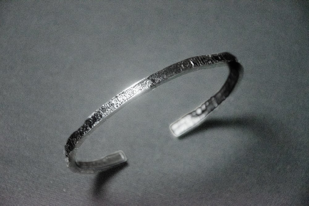 Image of Fracture Line