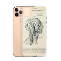 Image 3 of Antique Bookpage Detailed Anatomical Illustration Human Head Clear Case for iPhone®