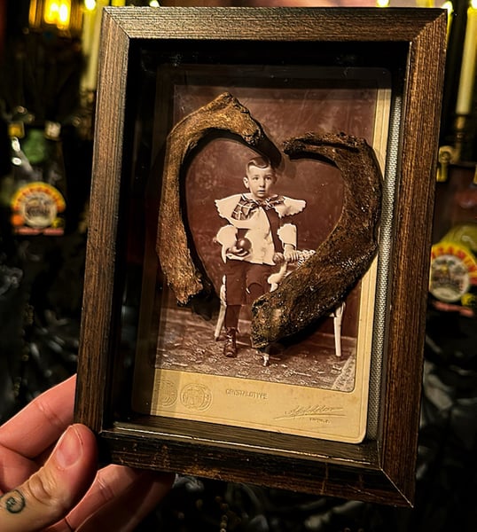 Image of Human Ribs & Victorian Cabinet Card in ShadowBox 