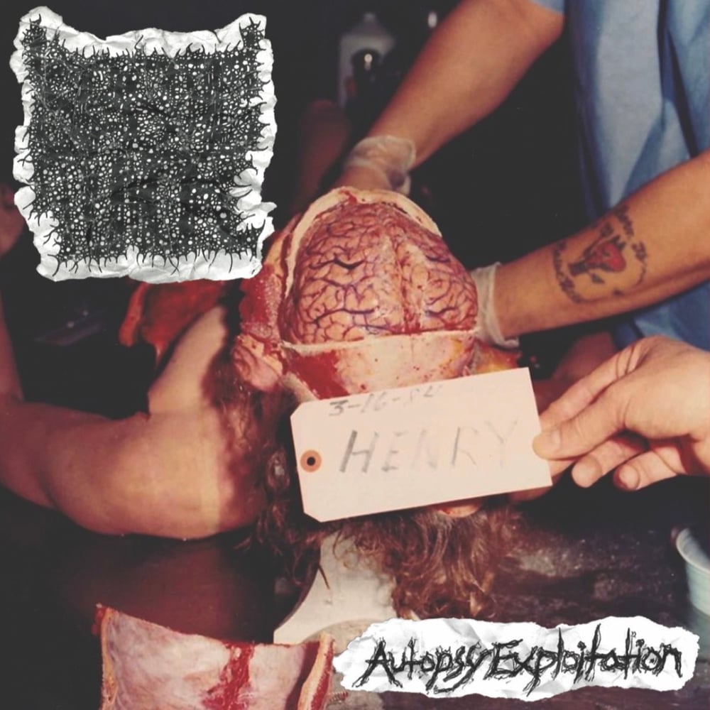 Spastic Tumor: Autopsy Exploitation- CD