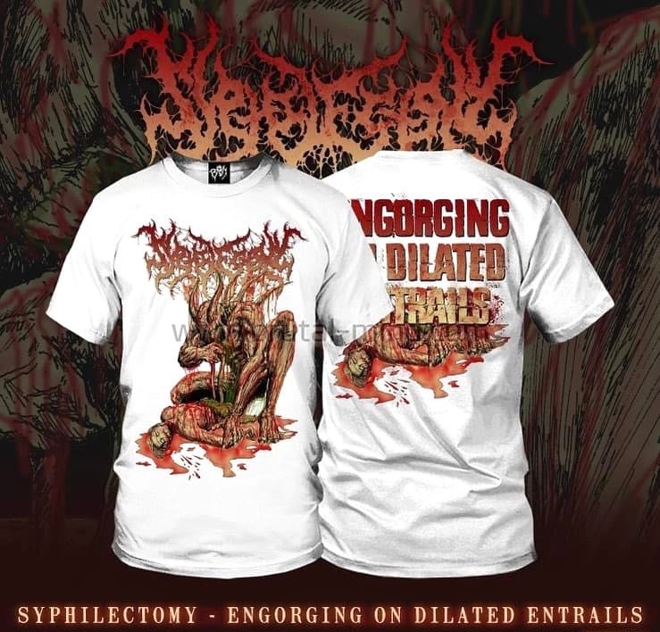 Syphilectomy -Engorging On Dilated Entrails