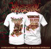 Image 1 of Syphilectomy -Engorging On Dilated Entrails