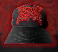 Image 2 of Viscera Infest-Verrucous Carcinoma