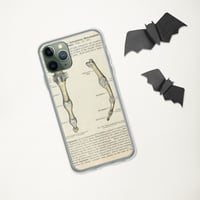 Image 5 of Antique Bookpage Detailed Anatomical Illustration Finger Bones Clear Case for iPhone®