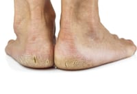 Image 4 of EXTREME SALTY FEET SOAK & SCRUB & EXTREME FOOT CREAM