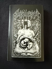 Image 1 of DISMORFIA -“ Regurgitation Of Maggots”