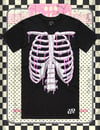 RIBCAGE (Strawberry)