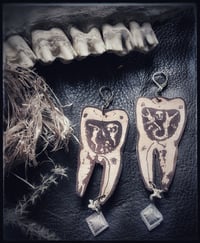 Tooth Dangles