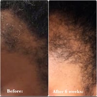 Image 2 of ROSE HAIR OIL (Growth Drops) 