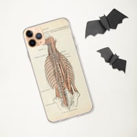 Image 3 of Antique Bookpage Detailed Anatomical Illustration Human Torso Clear Case for iPhone®