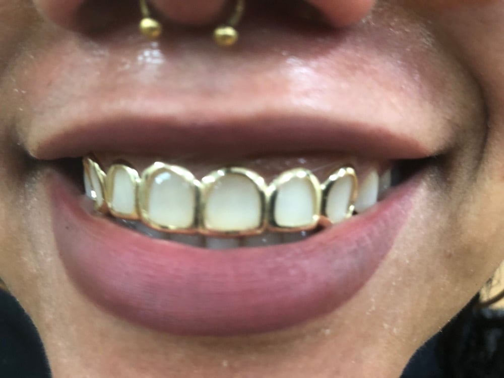 Image of 6 teeth grillz 10k yellow gold