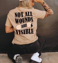 Not All Wounds Are Visible