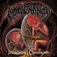 Malignancy - “Intrauterine Cannibalism” LP