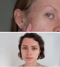 Image 3 of “DIAMONDS” CORRECTING CREAM w/DEOXYARBUTIN, ALPHA ARBUTIN, KOJIC DIPALMITATE (Extra Strength) 