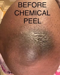 Image 5 of “BRIGHTER SKIN” PEELING OIL 