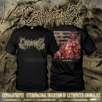 Image 1 of Cephalotripsy - SS 