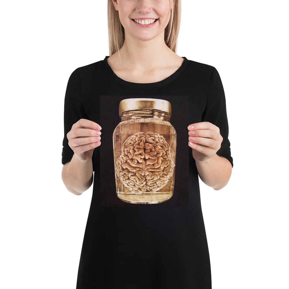 Photo Print: Brain Wet Specimen (black)