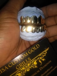 Image 5 of 10k Gold Per Tooth 