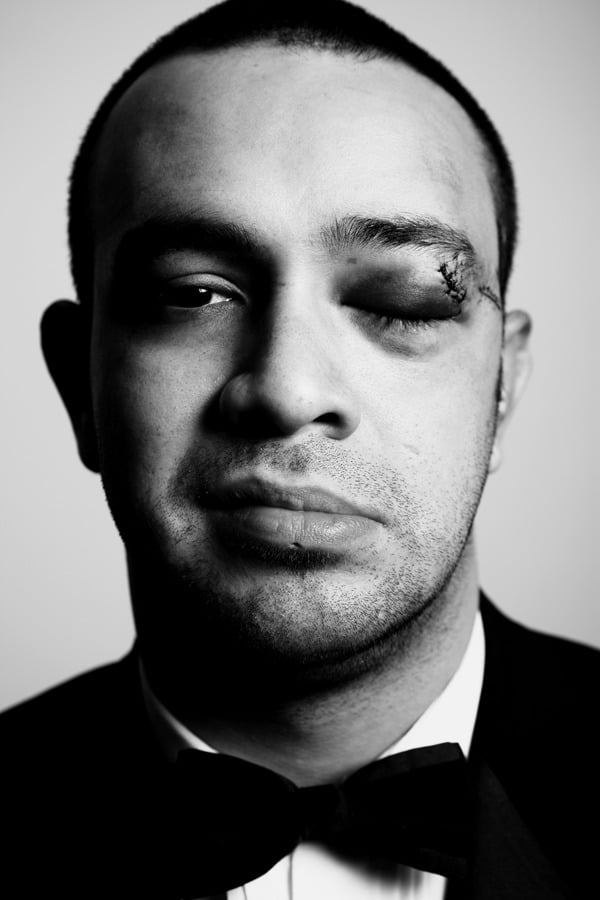 Image of rocky's eye.