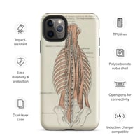 Image 4 of Antique Bookpage Detailed Anatomical Illustration Human Torso Tough Case for iPhone®